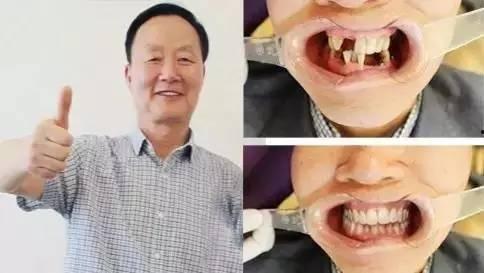 缺牙最新吃瓜视频,揭秘缺牙界的惊天秘密！